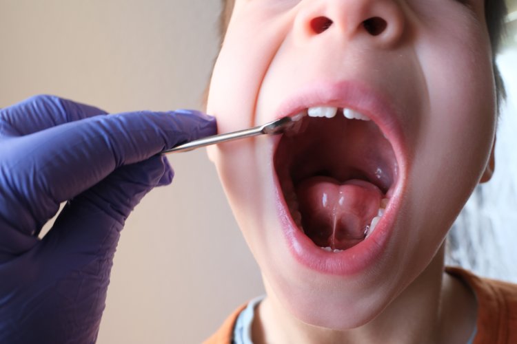 Describe a Tongue-Tie. A Comprehensive Guide to Help Parents Handle Frenulums, Fussiness, and Feeding