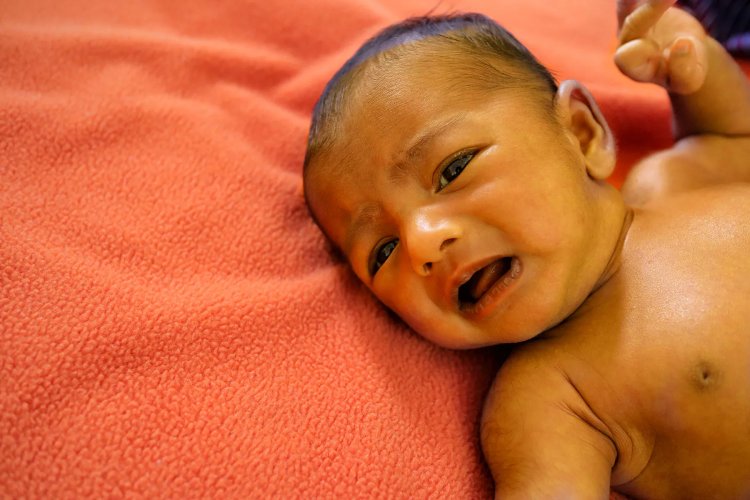 What Modern Parents Should Know About Newborn Jaundice (And Why It is Not Always a Bad Thing)