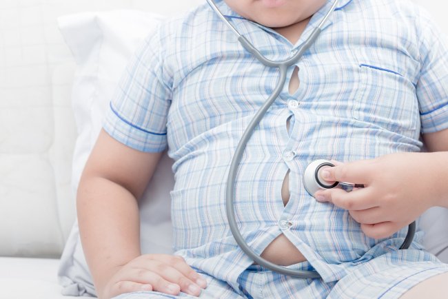 Weight Loss Surgery for Children and Teens Struggling With Obesity