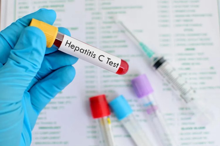 Baby Boomers and Hepatitis C: Why is it important to pay attention to this age group?