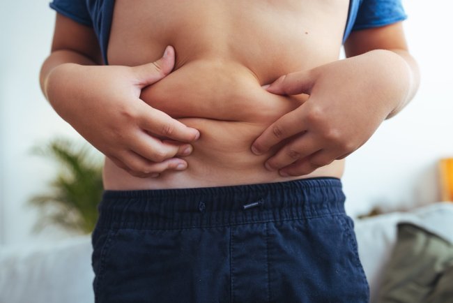 More Than Half of Today’s Children Could Become Obese Adults  And It Starts Earlier Than You Think