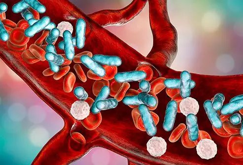 This could occasionally indicate a dangerous infection that needs immediate medical attention.