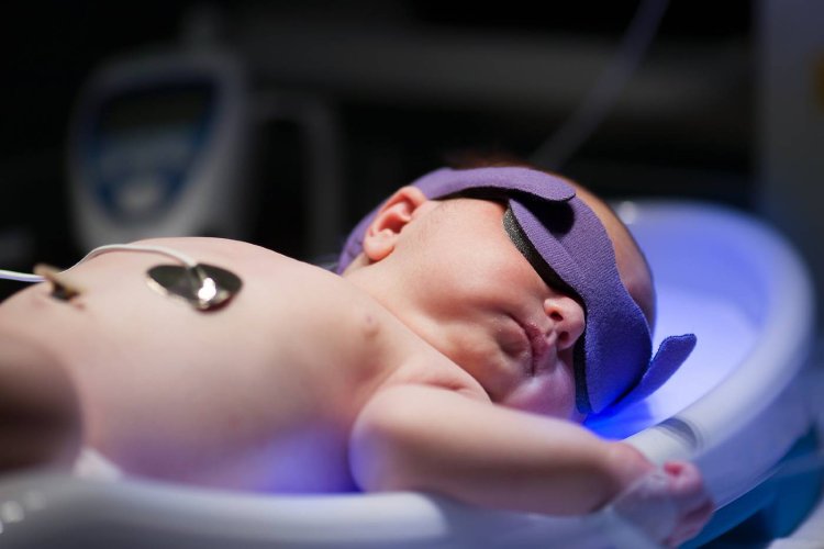 What Modern Parents Should Know About Newborn Jaundice (And Why It is Not Always a Bad Thing)
